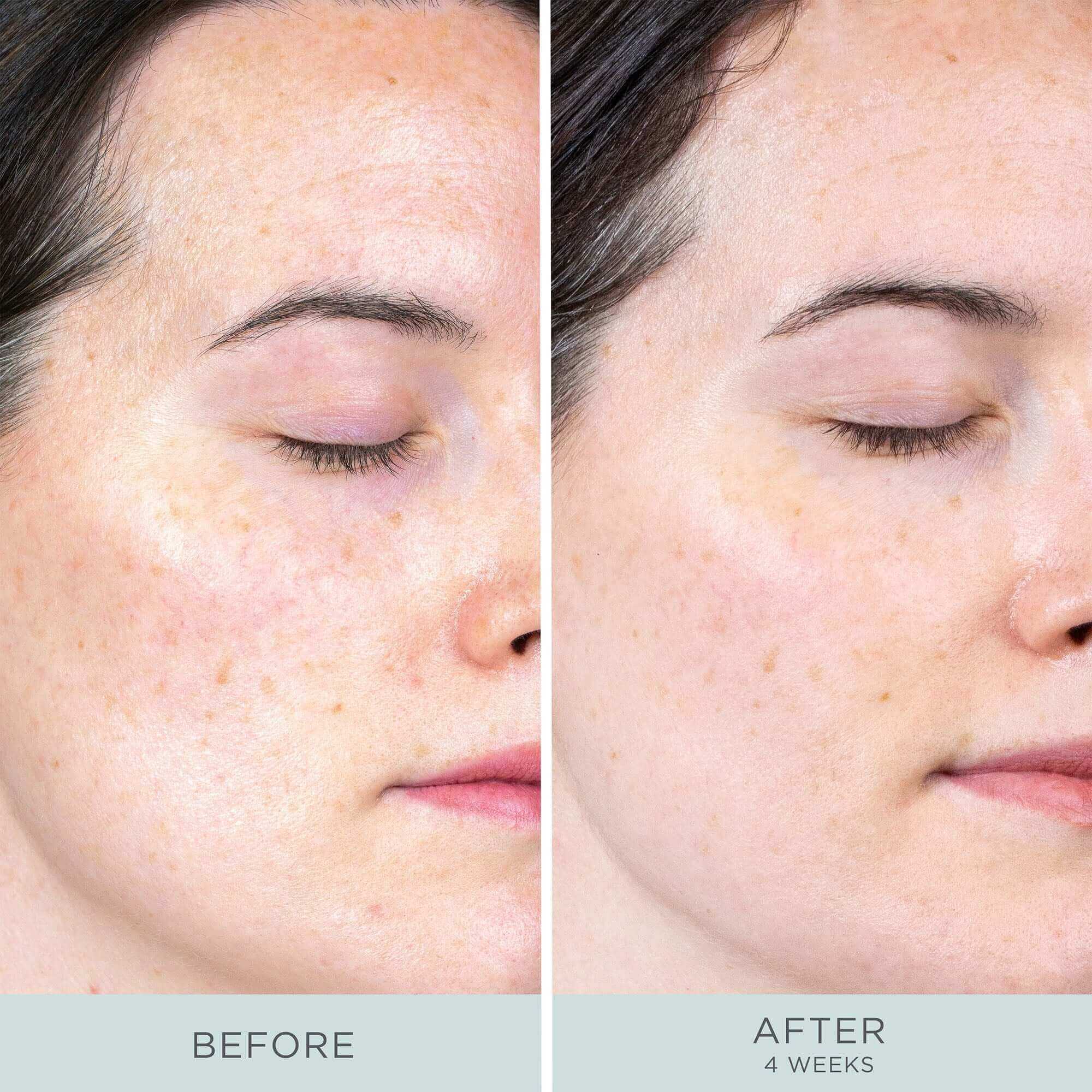 Firm & Glow System - Image 7